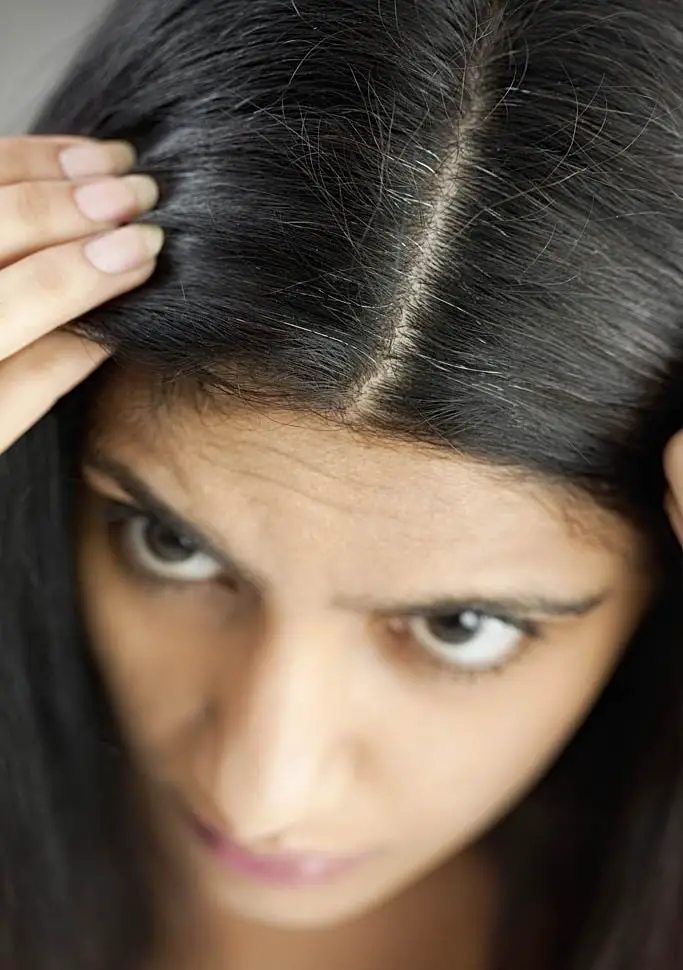White Hair Treatment In Homeopathy- Medicine To Turn White Hair Into Black  