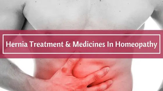 Hernia Treatment & Medicines In Homeopathy Hernia Treatment & Medicines In Homeopathy